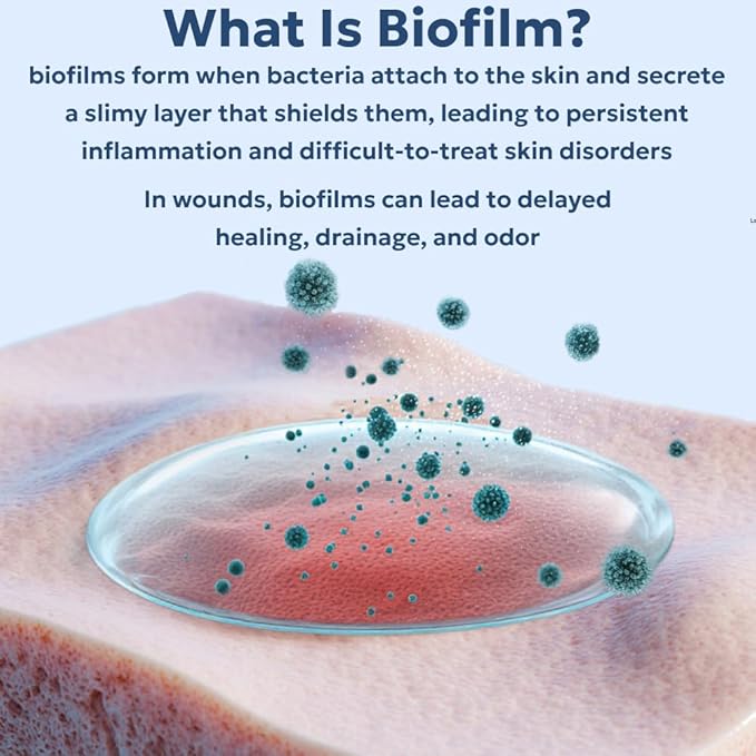 Forticept Blue Butter – Hot Spot Treatment for Dogs | Dog Wound Care | Skin Yeast Infections, Ringworm, Cuts, Rashes, First Aid Veterinary Strength Topical Ointment 4oz